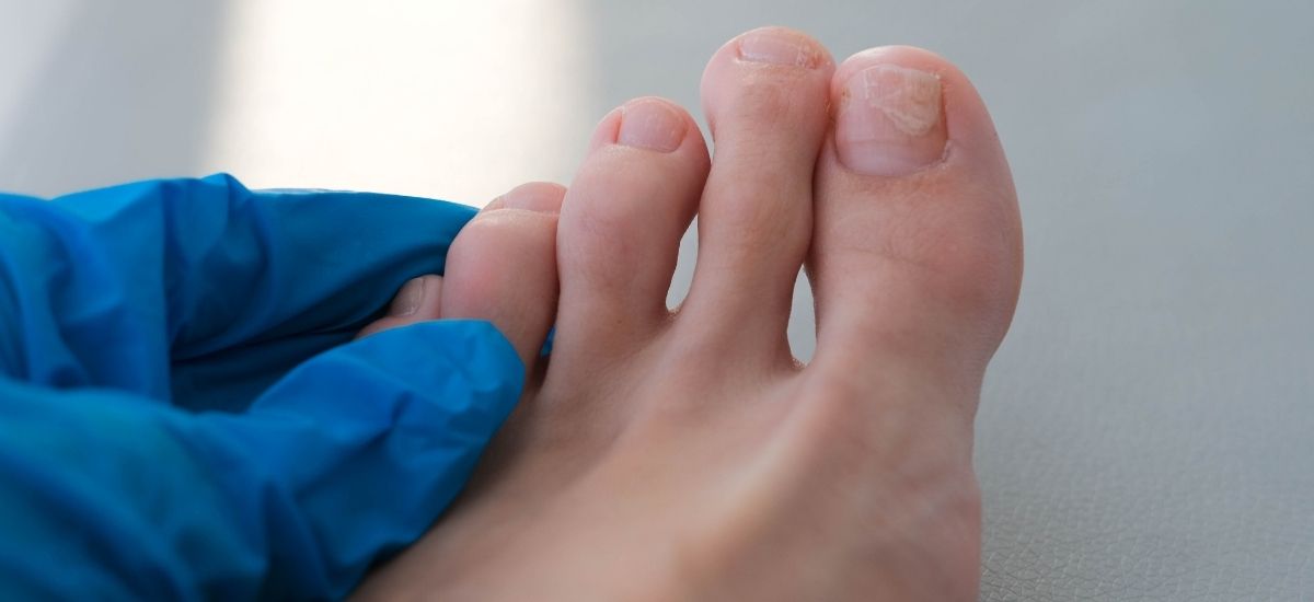 Morton's Neuroma Treatment